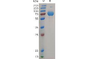 Human IF Protein, hFc Tag on SDS-PAGE under reducing condition.