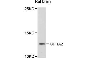 Western blot analysis of extracts of rat brain cells, using GPHA2 antibody. (GPHa2 anticorps)