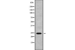 Western blot analysis of MRPS26 using Jurkat whole cell lysates (MRPS26 anticorps  (Internal Region))