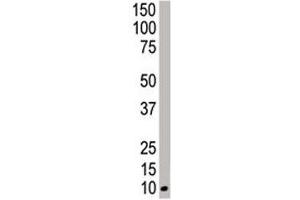 Western blot analysis of NEDD8 antibody and HeLa cell lysate