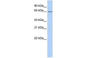 WB Suggested Anti-ACOT12 Antibody Titration: 0.
