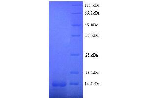 SDS-PAGE (SDS) image for Early Growth Response 1 (EGR1) (AA 444-543), (partial) protein (His tag) (ABIN5713418)