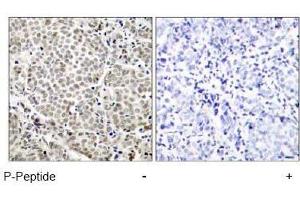 Image no. 1 for anti-Nuclear Factor-kB p65 (NFkBP65) (pSer529) antibody (ABIN196955) (NF-kB p65 anticorps  (pSer529))