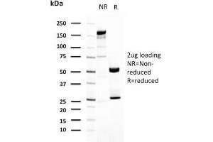 SDS-PAGE Analysis Purified Uroplakin 1A Mouse Monoclonal Antibody (UPK1A/2921).