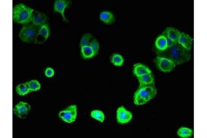 Immunofluorescent analysis of A431 cells using ABIN7153331 at dilution of 1:100 and Alexa Fluor 488-congugated AffiniPure Goat Anti-Rabbit IgG(H+L)