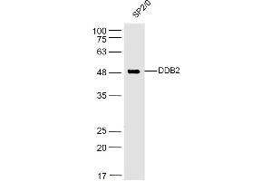 SP2/0 lysates probed with DDB2 Polyclonal Antibody, Unconjugated  at 1:500 dilution and 4˚C overnight incubation.