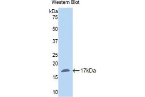 Western blot analysis of the recombinant protein. (NNMT anticorps  (AA 127-249))
