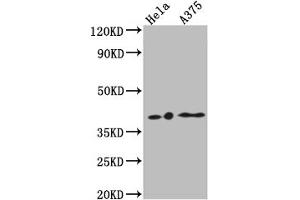Western Blot Positive WB detected in: Hela whole cell lysate, A375 whole cell lysate All lanes: EDG2 antibody at 1:1000 Secondary Goat polyclonal to rabbit IgG at 1/50000 dilution Predicted band size: 42, 42 kDa Observed band size: 42 kDa (Recombinant LPAR1 anticorps)