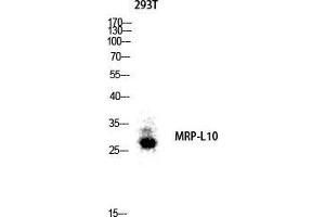 Western Blot (WB) analysis of 293T lysis using MRP-L10 antibody.