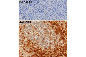 Immunohistochemistry (IHC) image for anti-CD5 (CD5) (AA 105-210) antibody (ABIN7272988) (CD5 anticorps  (AA 105-210))