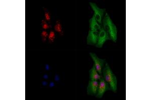 ABIN6264185 and ABIN6279642 staining  cells by IF/ICC. (PHOX2B anticorps  (Internal Region))
