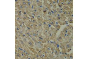 Immunohistochemistry of paraffin-embedded mouse heart using CCBL1 antibody (ABIN5973926) at dilution of 1/100 (40x lens). (CCBL1 anticorps)