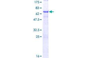 Image no. 1 for Melanoma Antigen Family A, 12 (MAGEA12) (AA 1-314) protein (GST tag) (ABIN1310033)