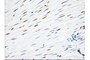 Immunohistochemical staining of paraffin-embedded Human Kidney tissue using anti-EIF2S1 mouse monoclonal antibody. (EIF2S1 anticorps)