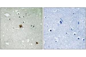 Immunohistochemistry analysis of paraffin-embedded human brain, using TOP2A (Phospho-Ser1525) Antibody.
