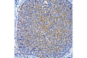 Immunohistochemistry of paraffin-embedded rat ovary using MAP1LC3A antibody. (MAP1LC3A anticorps)