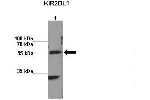 Amount and Sample Type: Lane 1:2x107 KIR2DL1 transfected NKL cells IP Antibody: KIR2DL1 Amount of IP Antibody: Primary Antibody: KIR2DL1 Primary Antibody Dilution: 1: x50Secondary Antibody: Anti-rabbit-HRP Secondary Antibody Dilution: 1:x0,000  Gene Name: KIR2DL1 Submitted by: Kerry S. (KIR2DL1 anticorps  (C-Term))
