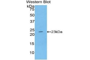 Western blot analysis of the recombinant protein. (IFNB1 anticorps  (AA 22-180))