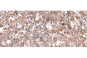 Immunohistochemistry of paraffin-embedded Human tonsil tissue using KBTBD11 Polyclonal Antibody at dilution of 1:35(x200) (KBTBD11 anticorps)