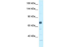 WB Suggested Anti-BRCA1 Antibody Titration: 0. (BRCA1 anticorps  (N-Term))