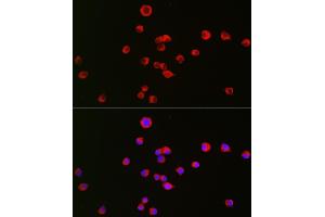 Immunofluorescence analysis of Neuro-2a cells using OPRK1 Rabbit pAb (ABIN6134089, ABIN6145043, ABIN6145045 and ABIN6218249) at dilution of 1:50 (40x lens).
