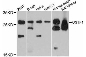 Western blot analysis of extracts of various cell lines, using OSTF1 antibody (ABIN5998422) at 1:3000 dilution.