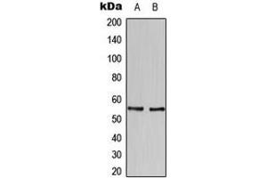 Western blot analysis of HBP1 expression in SKBR3 (A), U937 (B) whole cell lysates.