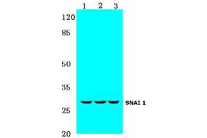 Western blot (WB) analysis of SNAI 1 antibody at 1/500 dilution: (SNAIL anticorps)