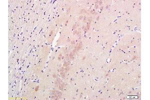 Formalin-fixed and paraffin embedded rat hippocampus labeled with Anti-Nestin Polyclonal Antibody , Unconjugated 1:300 followed by conjugation to the secondary antibody and DAB staining