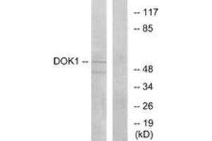 Western blot analysis of extracts from Jurkat cells, using p62 Dok (Ab-362) Antibody. (DOK1 anticorps  (AA 329-378))