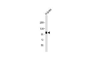 Anti-ADTS17 Antibody (N-term) at 1:2000 dilution + human brain lysate Lysates/proteins at 20 μg per lane. (ADAMTS17 anticorps  (N-Term))