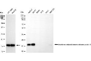 Western blotting analysis using interferon induced transmembrane protein 3 antibody (ABIN7799091). (Recombinant IFITM3 anticorps)