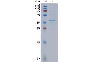 Human B13 Protein, Flag Tag on SDS-PAGE under reducing condition.