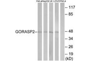 Western blot analysis of extracts from HeLa/HepG2/Jurkat/LOVO cells, using GORASP2 Antibody. (GORASP2 anticorps  (AA 181-230))