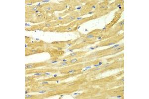 Immunohistochemistry of paraffin-embedded rat heart using OGT antibody at dilution of 1:100 (x40 lens). (OGT anticorps)