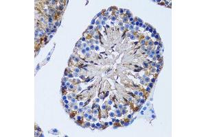 Immunohistochemistry of paraffin-embedded rat testis using IMPA1 antibody. (IMPA1 anticorps  (AA 1-277))