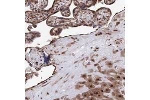 Immunohistochemical staining of human placenta with ZNF655 polyclonal antibody  shows strong nuclear positivity in trophoblastic cells at 1:200-1:500 dilution.
