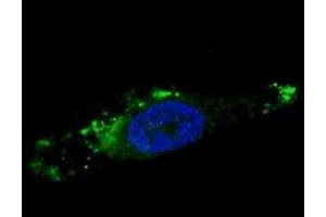 Fluorescent image of chloroquine-treated U251 cells stained with ATG12 antibody.