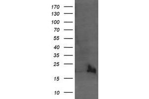 Image no. 11 for anti-Ubiquitin-Conjugating Enzyme E2G 2 (UBE2G2) antibody (ABIN1501630)