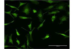 Immunofluorescence of monoclonal antibody to PURA on HeLa cell. (PURA anticorps  (AA 183-292))