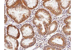 IHC-P Image Immunohistochemical analysis of paraffin-embedded human gastric tissue, using Periostin, antibody at 1:100 dilution.