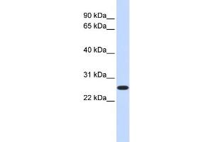 WB Suggested Anti-DULLARD Antibody Titration:  0. (CTDNEP1A anticorps  (Middle Region))