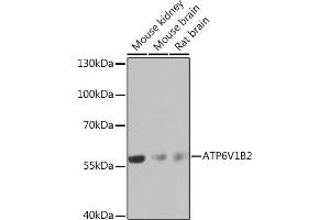 Western blot analysis of extracts of various cell lines, using V1B2 Rabbit pAb  at 1:1000 dilution. (ATP6V1B2 anticorps  (AA 262-511))