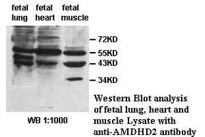 Image no. 1 for anti-Amidohydrolase Domain Containing 2 (AMDHD2) antibody (ABIN1574657) (AMDHD2 anticorps)