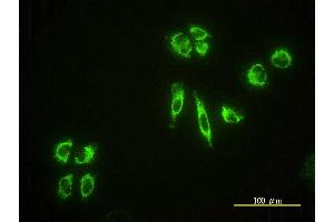 Immunofluorescence of monoclonal antibody to EHD4 on HeLa cell. (EHD4 anticorps  (AA 1-541))