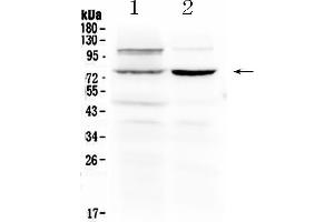 Western blot analysis of Dishevelled 2 using anti- Dishevelled 2 antibody . (DVL2 anticorps  (N-Term))