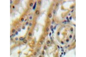 IHC-P analysis of Kidney tissue, with DAB staining. (Betacellulin anticorps  (AA 32-118))