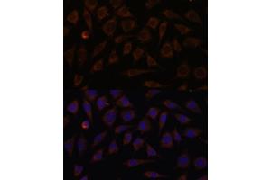 Immunofluorescence analysis of L929 cells using VILL antibody (ABIN7271325) at dilution of 1:100.