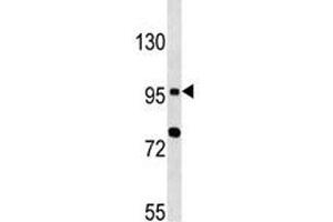 TLR6 antibody western blot analysis in MCF-7 lysate