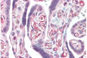 Human Placenta (formalin-fixed, paraffin-embedded) stained with CFLAR antibody ABIN461877 at 5 ug/ml followed by biotinylated goat anti-rabbit IgG secondary antibody ABIN481713, alkaline phosphatase-streptavidin and chromogen.